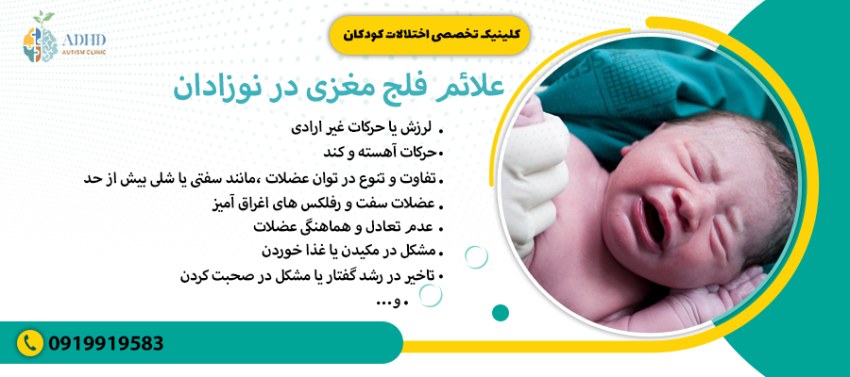 علائم فلج مغزی در نوزادان